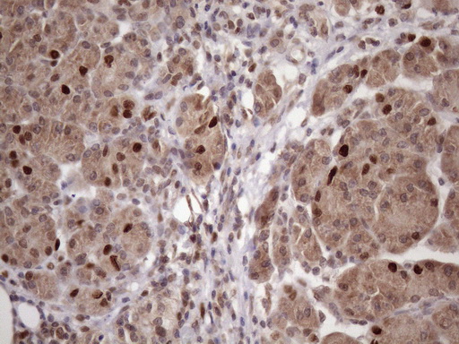 BTEB / KLF9 Antibody - Immunohistochemical staining of paraffin-embedded Human pancreas tissue within the normal limits using anti-KLF9 mouse monoclonal antibody. (Heat-induced epitope retrieval by 1mM EDTA in 10mM Tris buffer. (pH8.5) at 120 oC for 3 min. (1:150)