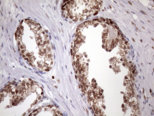 BTEB / KLF9 Antibody - Immunohistochemical staining of paraffin-embedded Human prostate tissue within the normal limits using anti-KLF9 mouse monoclonal antibody. (Heat-induced epitope retrieval by 1mM EDTA in 10mM Tris buffer. (pH8.5) at 120 oC for 3 min. (1:150)