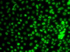 BTEB / KLF9 Antibody - Immunofluorescence analysis of A549 cells.