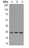 BTEB / KLF9 Antibody - Western blot analysis of BTEB1 expression in mouse lung (A); mouse liver (B); rat brain (C) whole cell lysates.