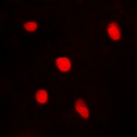BTEB / KLF9 Antibody - Immunofluorescent analysis of BTEB1 staining in A549 cells. Formalin-fixed cells were permeabilized with 0.1% Triton X-100 in TBS for 5-10 minutes and blocked with 3% BSA-PBS for 30 minutes at room temperature. Cells were probed with the primary antibody in 3% BSA-PBS and incubated overnight at 4 deg C in a humidified chamber. Cells were washed with PBST and incubated with a DyLight 594-conjugated secondary antibody (red) in PBS at room temperature in the dark.