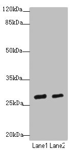 BTEB / KLF9 Antibody - Western blot All Lanes: KLF9antibody at 4.43ug/ml Lane 1: Mouse kidney tissue Lane 2: Mouse liver tissue Secondary Goat polyclonal to Rabbit IgG at 1/10000 dilution Predicted band size: 27 kDa Observed band size: 27 kDa
