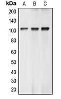 BTF / BCLAF1 Antibody - Western blot analysis of BCLAF1 expression in K562 (A); MCF7 (B); A549 (C) whole cell lysates.