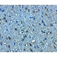BTF / BCLAF1 Antibody - Immunohistochemistry of BCLAF1 in mouse brain tissue with BCLAF1 antibody at 5 µg/mL.
