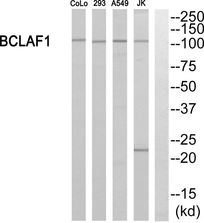 BTF / BCLAF1 Antibody - Western blot analysis of extracts from 293 cells, Jurkat cells and A549 cells, using BCLAF1 antibody.