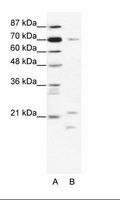 BTF3 Antibody - A: Marker, B: Jurkat Cell Lysate.  This image was taken for the unconjugated form of this product. Other forms have not been tested.