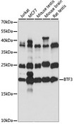 BTF3 Antibody - Western blot analysis of extracts of various cell lines, using BTF3 antibody at 1:1000 dilution. The secondary antibody used was an HRP Goat Anti-Rabbit IgG (H+L) at 1:10000 dilution. Lysates were loaded 25ug per lane and 3% nonfat dry milk in TBST was used for blocking. An ECL Kit was used for detection and the exposure time was 10S.