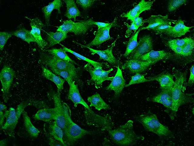 BTF3 Antibody - Immunofluorescence staining of BTF3 in U251MG cells. Cells were fixed with 4% PFA, permeabilzed with 0.1% Triton X-100 in PBS, blocked with 10% serum, and incubated with rabbit anti-Human BTF3 polyclonal antibody (dilution ratio 1:200) at 4°C overnight. Then cells were stained with the Alexa Fluor 488-conjugated Goat Anti-rabbit IgG secondary antibody (green) and counterstained with DAPI (blue). Positive staining was localized to Cytoplasm.