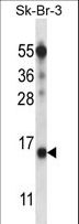 BTF3L4 Antibody - BTF3L4 Antibody western blot of SK-BR-3 cell line lysates (35 ug/lane). The BTF3L4 antibody detected the BTF3L4 protein (arrow).