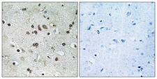 BTF3L4 Antibody - Immunohistochemistry analysis of paraffin-embedded human brain tissue, using BTF3L4 Antibody. The picture on the right is blocked with the synthesized peptide.