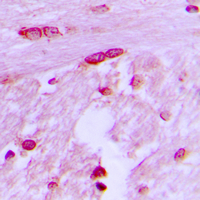BTF3L4 Antibody - Immunohistochemical analysis of BTF3L4 staining in human brain formalin fixed paraffin embedded tissue section. The section was pre-treated using heat mediated antigen retrieval with sodium citrate buffer (pH 6.0). The section was then incubated with the antibody at room temperature and detected using an HRP conjugated compact polymer system. DAB was used as the chromogen. The section was then counterstained with hematoxylin and mounted with DPX.