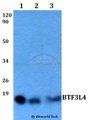 BTF3L4 Antibody - Western blot of BTF3L4 antibody at 1:500 dilution. Lane 1: HEK293T whole cell lysate. Lane 2: sp2/0 whole cell lysate. Lane 3: PC12 whole cell lysate.