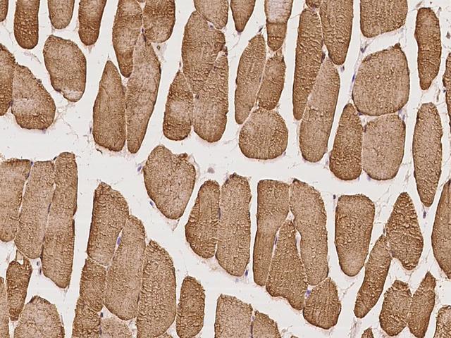 BTF3L4 Antibody - Immunochemical staining of human BTF3L4 in human skeletal muscle with rabbit polyclonal antibody at 1:100 dilution, formalin-fixed paraffin embedded sections.