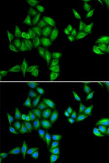 BTG1 Antibody - Immunofluorescence analysis of HeLa cells.