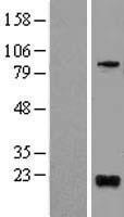 BTG1 Protein - Western validation with an anti-DDK antibody * L: Control HEK293 lysate R: Over-expression lysate