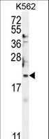 BTG2 Antibody - BTG2 Antibody western blot of K562 cell line lysates (35 ug/lane). The BTG2 antibody detected the BTG2 protein (arrow).