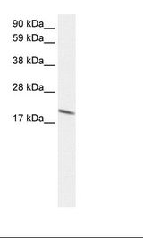 BTG2 Antibody - Fetal Lung Lysate.  This image was taken for the unconjugated form of this product. Other forms have not been tested.