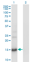 BTG2 Antibody - Western Blot analysis of BTG2 expression in transfected 293T cell line by BTG2 monoclonal antibody (M01), clone 1A5.Lane 1: BTG2 transfected lysate(17.4 KDa).Lane 2: Non-transfected lysate.