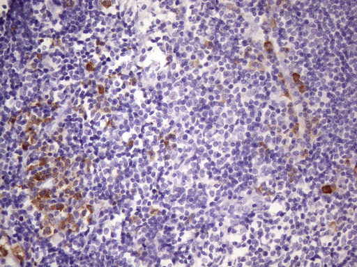 BTG2 Antibody - Immunohistochemical staining of paraffin-embedded Human tonsil within the normal limits using anti-BTG2 mouse monoclonal antibody. (Heat-induced epitope retrieval by 1 mM EDTA in 10mM Tris, pH8.5, 120C for 3min. (1:150)