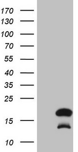 BTG2 Antibody - HEK293T cells were transfected with the pCMV6-ENTRY control (Left lane) or pCMV6-ENTRY BTG2 (Right lane) cDNA for 48 hrs and lysed. Equivalent amounts of cell lysates (5 ug per lane) were separated by SDS-PAGE and immunoblotted with anti-BTG2 (1:2000).