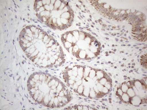 BTG2 Antibody - Immunohistochemical staining of paraffin-embedded Human colon tissue within the normal limits using anti-BTG2 mouse monoclonal antibody. (Heat-induced epitope retrieval by 1mM EDTA in 10mM Tris buffer. (pH8.5) at 120°C for 3 min. (1:150)