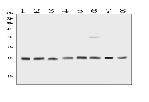 BTG2 Antibody - Western blot analysis of BTG2 using anti-BTG2 antibody. Electrophoresis was performed on a 5-20% SDS-PAGE gel at 70V (Stacking gel) / 90V (Resolving gel) for 2-3 hours. The sample well of each lane was loaded with 50ug of sample under reducing conditions. Lane 1: rat brain tissue lysates,Lane 2: rat brain tissue lysates,Lane 3: rat kidney tissue lysates,Lane 4: mouse brain tissue lysates,Lane 5: mouse brain tissue lysates,Lane 6: mouse kidney tissue lysates,Lane 7: human MDA-MB-231 whole cell lysates, Lane 8: human MDA-MB-453 whole cell lysates. After Electrophoresis, proteins were transferred to a Nitrocellulose membrane at 150mA for 50-90 minutes. Blocked the membrane with 5% Non-fat Milk/ TBS for 1.5 hour at RT. The membrane was incubated with rabbit anti-BTG2 antigen affinity purified polyclonal antibody at 0.5 µg/mL overnight at 4°C, then washed with TBS-0.1% Tween 3 times with 5 minutes each and probed with a goat anti-rabbit IgG-HRP secondary antibody at a dilution of 1:10000 for 1.5 hour at RT. The signal is developed using an Enhanced Chemiluminescent detection (ECL) kit with Tanon 5200 system. A specific band was detected for BTG2 at approximately 17KD. The expected band size for BTG2 is at 17KD.