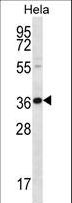 BTG3 Antibody - BTG3 Antibody western blot of HeLa cell line lysates (35 ug/lane). The BTG3 antibody detected the BTG3 protein (arrow).