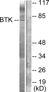 BTK Antibody - Western blot analysis of lysates from HeLa cells, using BTK Antibody. The lane on the right is blocked with the synthesized peptide.