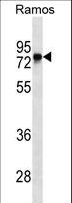 BTK Antibody - BTK Antibody western blot of Ramos cell line lysates (35 ug/lane). The BTK antibody detected the BTK protein (arrow).