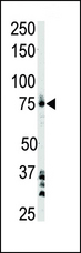 BTK Antibody - The anti-BTK antibody is used in Western blot to detect BTK in Ramos cell lysate.