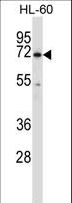 BTK Antibody - BTK Antibody western blot of HL-60 cell line lysates (35 ug/lane). The BTK antibody detected the BTK protein (arrow).