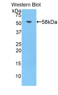 BTK Antibody - Western blot of recombinant BTK.  This image was taken for the unconjugated form of this product. Other forms have not been tested.