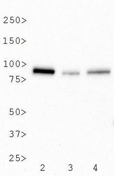 BTK Antibody - Western Blot: BTK Antibody (7F12H4) - Analysis of BTK expression in 2) Raji, 3) A431 whole cell lysates and 4) human tonsil tissue extract.