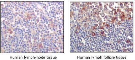 BTK Antibody - Immunohistochemistry-Paraffin: BTK Antibody (7F12H4) - Immunohistochemical analysis of paraffin-embedded human lymph-node tissues (left) and human lymph follicle tissues (right), showing cytoplasmic and membrane localization using BTK mouse mAb with DAB staining.