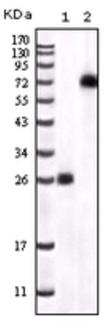 BTK Antibody - Western Blot: BTK Antibody (7F12H4) - Analysis of BTK expression in 1) truncated BTK recombinant protein and 2) K562 cell lysate.