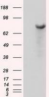 BTK Antibody - HEK293T cells were transfected with the pCMV6-ENTRY control (Left lane) or pCMV6-ENTRY BTK (Right lane) cDNA for 48 hrs and lysed. Equivalent amounts of cell lysates (5 ug per lane) were separated by SDS-PAGE and immunoblotted with anti-BTK.