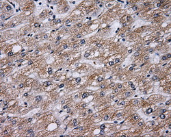 BTK Antibody - IHC of paraffin-embedded liver tissue using anti-BTK mouse monoclonal antibody. (Dilution 1:50).