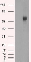 BTK Antibody - HEK293T cells were transfected with the pCMV6-ENTRY control (Left lane) or pCMV6-ENTRY BTK (Right lane) cDNA for 48 hrs and lysed. Equivalent amounts of cell lysates (5 ug per lane) were separated by SDS-PAGE and immunoblotted with anti-BTK.