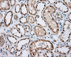 BTK Antibody - IHC of paraffin-embedded Kidney tissue using anti-BTK mouse monoclonal antibody. (Dilution 1:50).