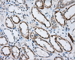 BTK Antibody - IHC of paraffin-embedded Kidney tissue using anti-BTK mouse monoclonal antibody. (Dilution 1:50).