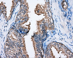 BTK Antibody - IHC of paraffin-embedded prostate tissue using anti-BTK mouse monoclonal antibody. (Dilution 1:50).