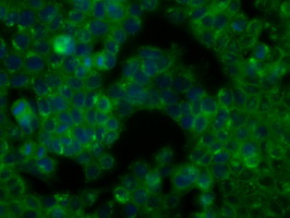 BTK Antibody - Immunofluorescent staining of HT29 cells using anti-BTK mouse monoclonal antibody.