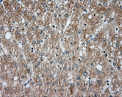 BTK Antibody - Immunohistochemical staining of paraffin-embedded liver tissue using anti-BTK mouse monoclonal antibody. (Dilution 1:50).