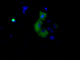 BTK Antibody - Anti-BTK mouse monoclonal antibody  immunofluorescent staining of COS7 cells transiently transfected by pCMV6-ENTRY BTK.