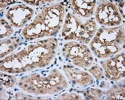 BTK Antibody - Immunohistochemical staining of paraffin-embedded Kidney tissue using anti-BTK mouse monoclonal antibody. (Dilution 1:50).