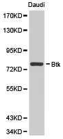 BTK Antibody - Western blot of extracts of Daudi cell lines, using BTK antibody.