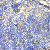 BTK Antibody - Immunohistochemistry of formalin-fixed paraffin-embedded (FFPE) mouse spleen using BTK antibody at dilution of 1:100 (40x magnification).