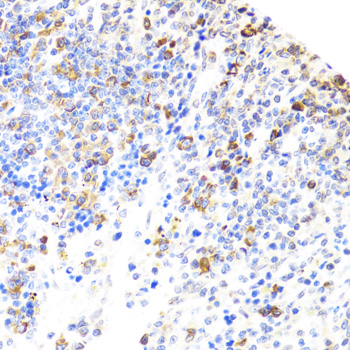 BTK Antibody - Immunohistochemistry of paraffin-embedded rat spleen using BTK antibodyat dilution of 1:100 (40x lens).