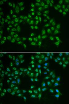 BTK Antibody - Immunofluorescence analysis of HeLa cells using BTK antibody. Blue: DAPI for nuclear staining.