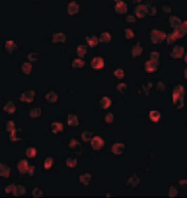 BTK Antibody - Immunofluorescence of BTK in Daudi cells with BTK antibody at 10 ug/ml.